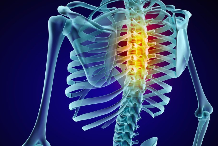 Osteofity kręgosłupa (osteofitoza) – przyczyny, objawy i leczenie osteofitów na kręgosłupie